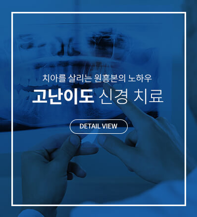 치아를 살리는 원흥본의 노하우. 고난이도 신경 치료.